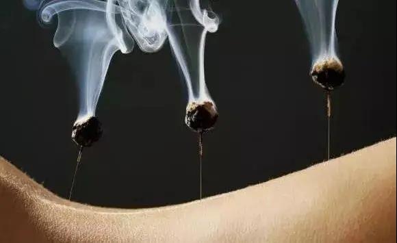 艾灸不是藥，調的不是病，央視為艾灸正名，讓我們正視艾灸