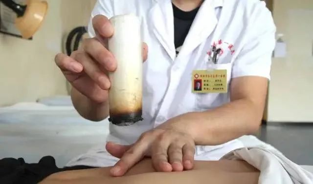 產(chǎn)后艾灸一個(gè)月，十年少生??！ 