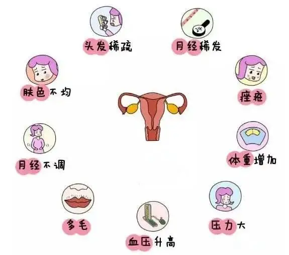 10個(gè)女人就有1個(gè)患多囊！被它纏上不要怕，艾灸幫你調“多囊”！
